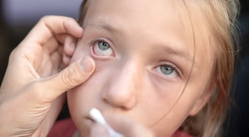 Foreign Body Removal